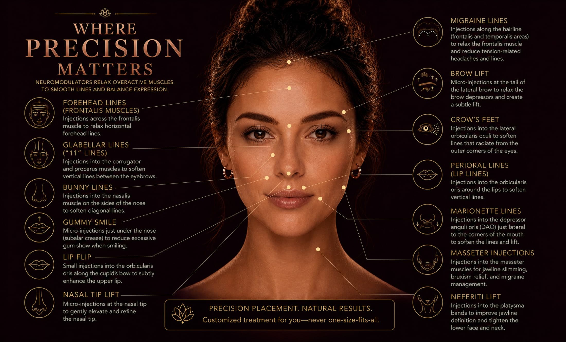 Face-map infographic titled Where Precision Matters showing common neuromodulator treatment zones with labels — forehead lines, glabellar (11) lines, bunny lines, lip flip, crow's feet, brow lift, perioral lines, and neck (platysmal band) treatment — each precisely placed for natural results.