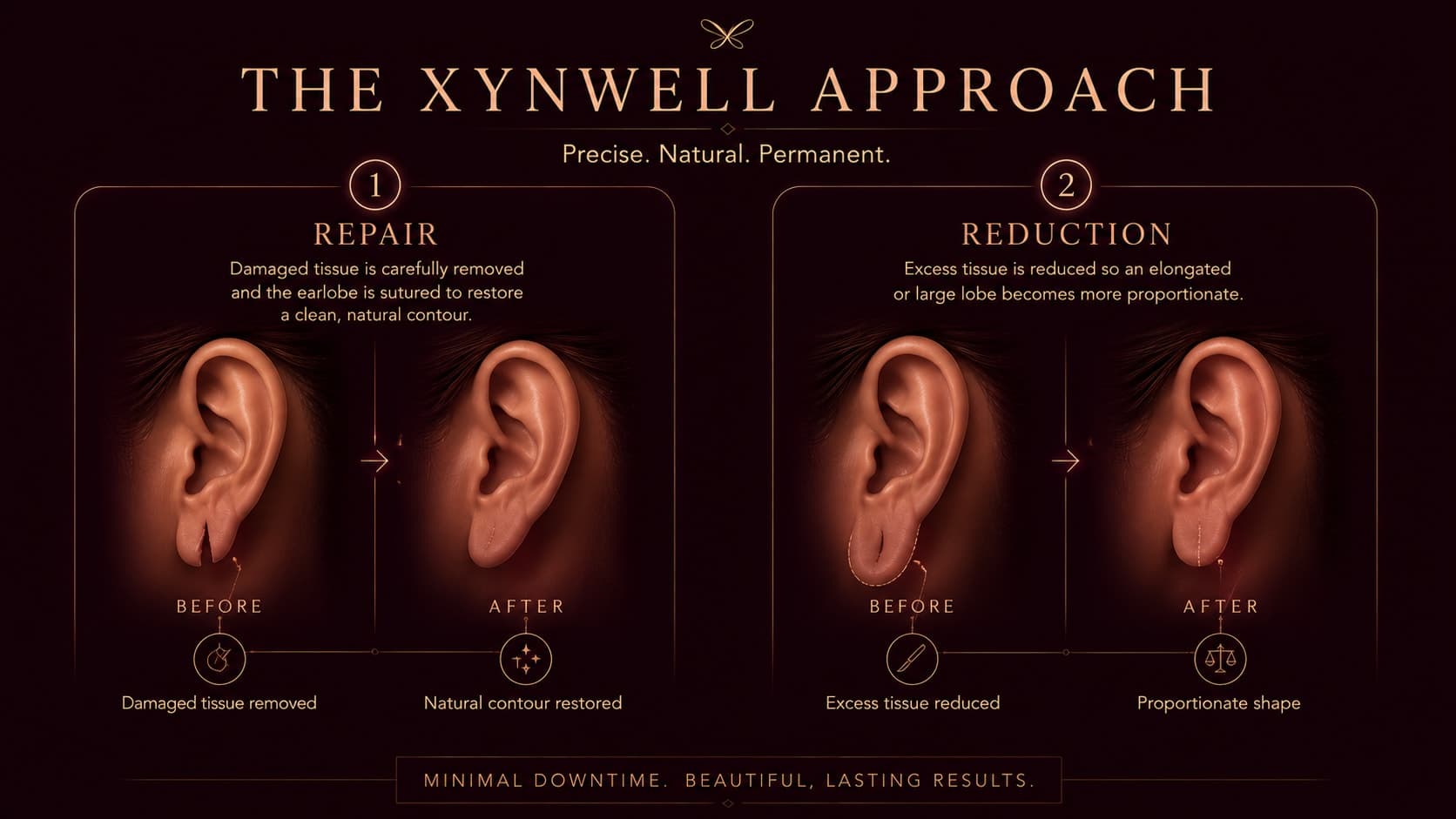 Two-step illustration of the Xynwell approach: Repair — damaged tissue removed and the earlobe sutured to restore a natural contour; and Reduction — excess tissue reduced so an elongated or large lobe becomes more proportionate, each shown before and after.
