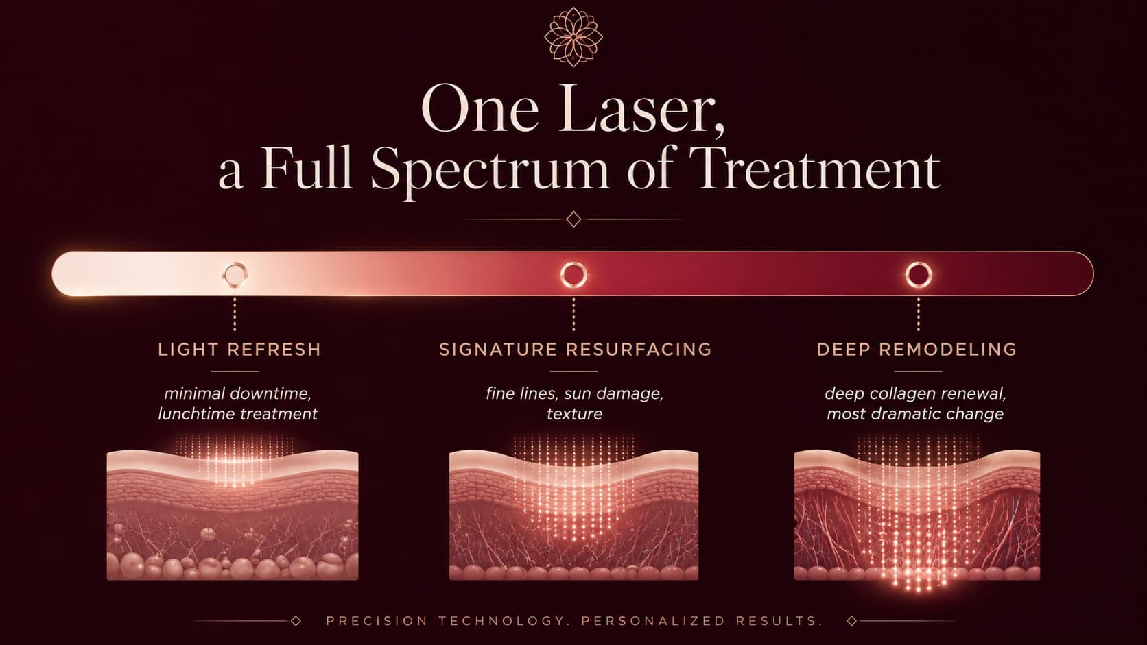Illustration titled One Laser, a Full Spectrum of Treatment showing UltraClear treatment intensity ranging from a light lunchtime refresh with minimal downtime, through signature resurfacing, to deep collagen remodeling with the most dramatic renewal.