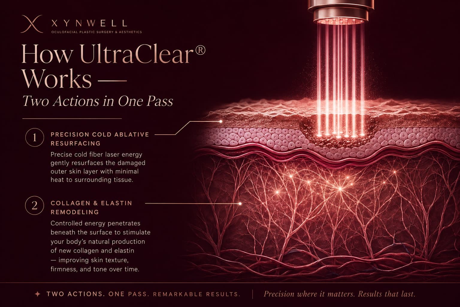 Illustration titled How UltraClear Works showing the cold fiber laser performing two actions in a single pass: precisely resurfacing damaged outer skin while depositing controlled energy beneath the surface to stimulate new collagen and elastin.